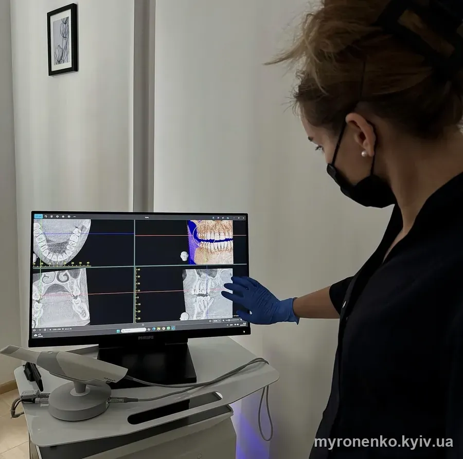 Врач планирует имплантацию по трёхмерному снимку компьютерной томографии