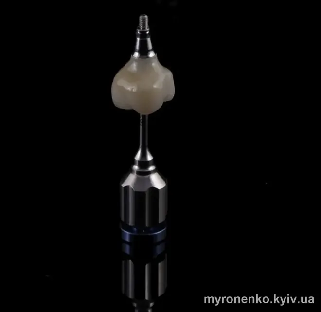 Керамическая коронка на титановом абатменте импланта — макросъёмка ортопедической работы