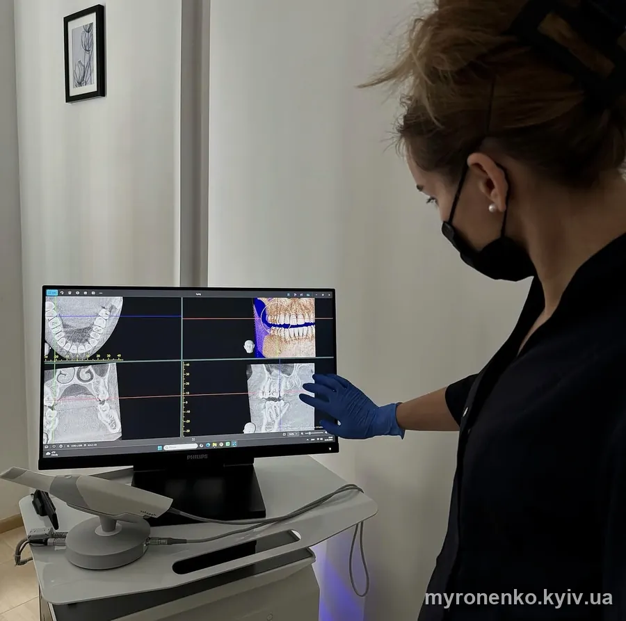 Лікар аналізує 3D-знімок (КТ) щелепи пацієнта